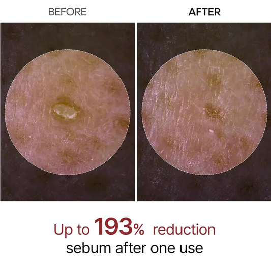 Peel Shot Glow Rice Ampoule™ Duo by Mr.Melaxin